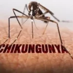 Khuyến cáo phòng chống bệnh Chikungunya