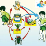 Bệnh lỵ trực trùng: Đặc điểm, nguy cơ và biện pháp phòng ngừa