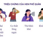 Hen suyễn: Nhận biết sớm và kiểm soát đúng cách để phòng biến chứng nguy hiểm