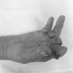 Luôn cẩn trọng trước những tai nạn sinh hoạt có thể xảy ra